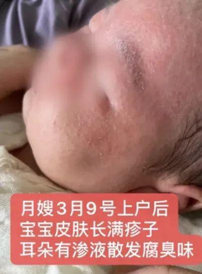 月嫂竟用高浓度酒精给刚出生的宝宝冲洗鼻腔？深圳月嫂公司：她夸大造谣…(图3)
